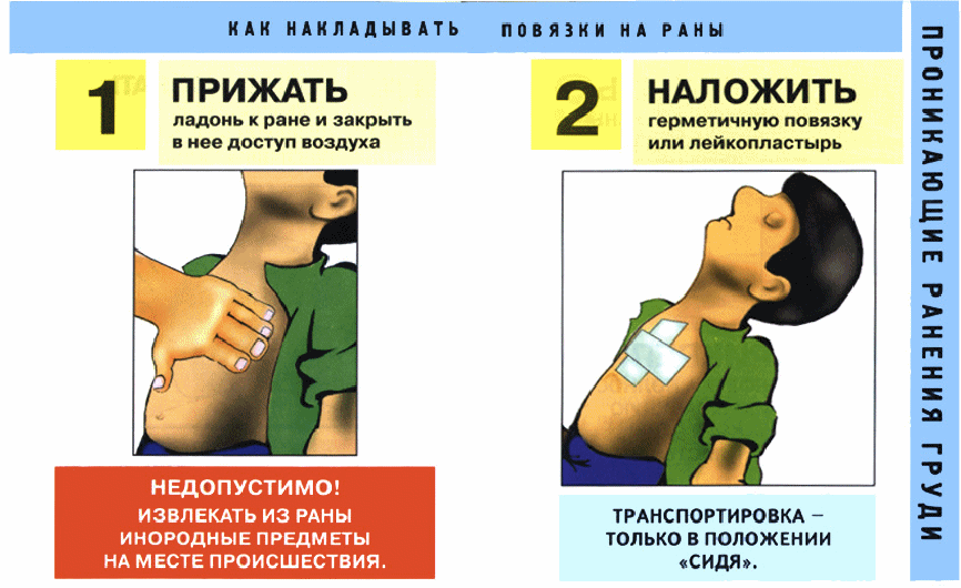 При каком повреждении применяется изображенная на картинке первая помощь